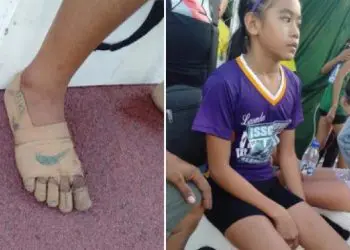 Филипинско момиче спечели три златни медала с обувки от лейкопласт