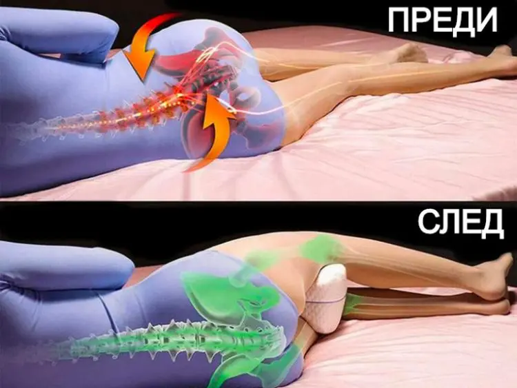 Спете с възглавница между краката! Има много ползи за здравето..