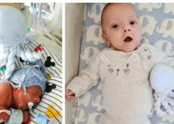 Това бебче се ражда в 25-тата седмица и е с големината на своя плюшен приятел – октопод, месеци по-късно?