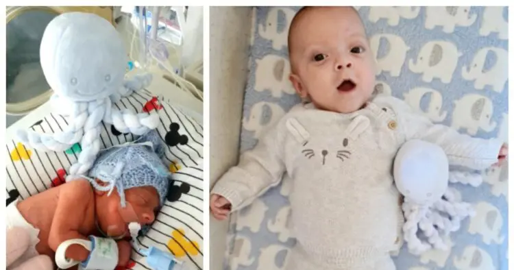 Това бебче се ражда в 25-тата седмица и е с големината на своя плюшен приятел – октопод, месеци по-късно?