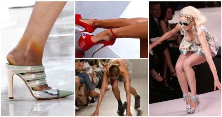 Неудобни, счупени, големи, малки – най-лошите страхове на моделите!