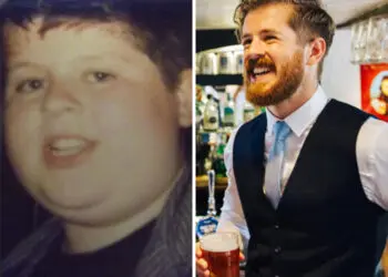 Хората, които преди бяха „грозните патета“, споделят своите зашеметяващи трансформации! (СНИМКИ)