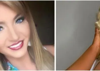 Поредната жертва на пластичната хирургия – от обикновено момиче до силиконова Барби