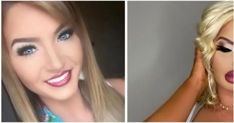 Поредната жертва на пластичната хирургия – от обикновено момиче до силиконова Барби