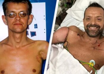 Първият човек в света с трансплантация на две ръце и рамо прави невероятно възстановяване