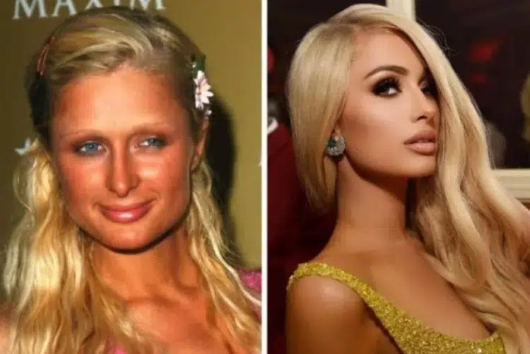 Знаменитости от 2000-те, които само родителите им могат да разпознаят..