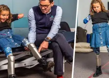 Във Великобритания за първи път инсталираха роботизирани крака за осемгодишно момиче
