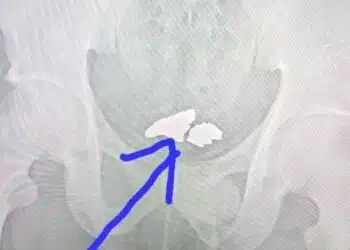 Работник поглъща откраднато злато, но е хванат от алармата на вратата