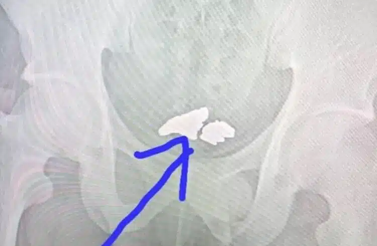 Работник поглъща откраднато злато, но е хванат от алармата на вратата