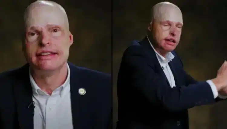 Историята на човек, който успява да скочи от горящ самолет и по чудо не загива