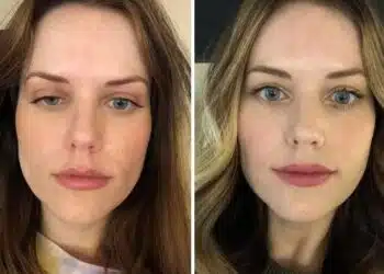 Хората, които не напразно са се обърнали към пластичен хирург