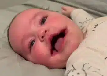 Един рядък случай. Момичето с „постоянната усмивка“