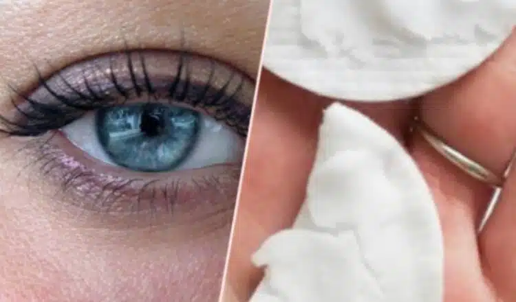 Естествени и ефективни начини за борба с тъмните кръгове и подпухналите очи