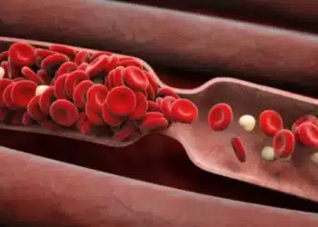 Ето начин за намаляване на риска от образуване на кръвни съсиреци