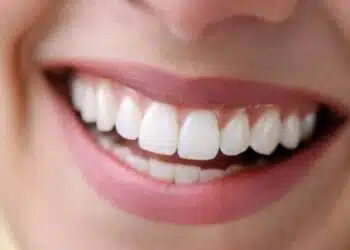 Зъболекар каза какво значи, ако зъбите ни болят повече през зимата