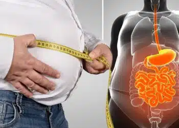 Какво е висцерална мазнина: Kак да се отървете от „натрупванията“