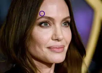 Ако имаш бенки на някое от тези места, това е знак за успех, късмет или богатство